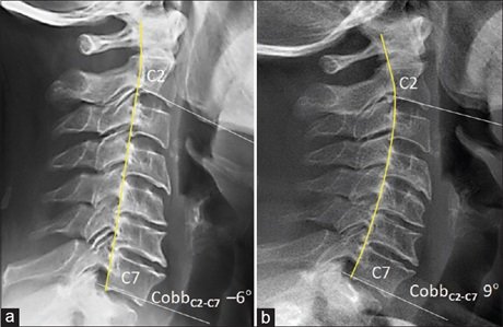 Cobb ab